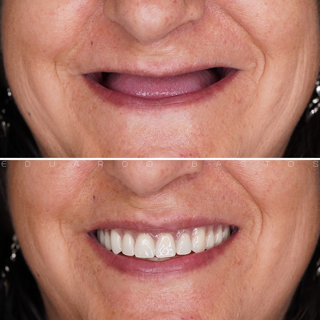 Patient Transformation 5