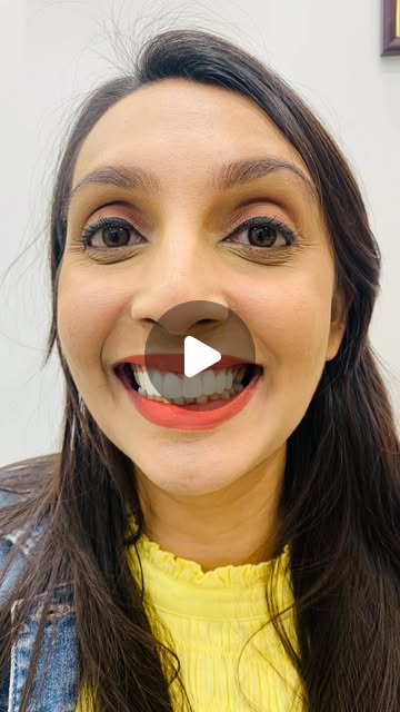 Implant Testimonial 3 preview