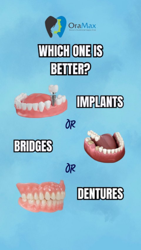 Implants vs Bridges vs Dentures